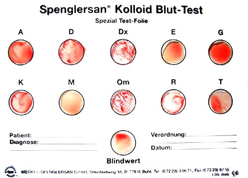 Spenglersan- Test: Die Reaktion des Blutes mit den Spenglersan- Kolloiden wird optisch ausgewertet